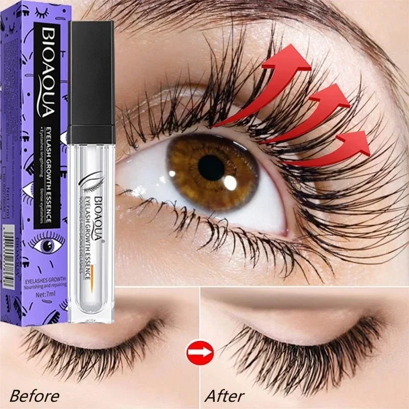Hızlı Büyüme Tedavisi Kirpik S - Lash Serum Growth incelemesi ve fiyatı